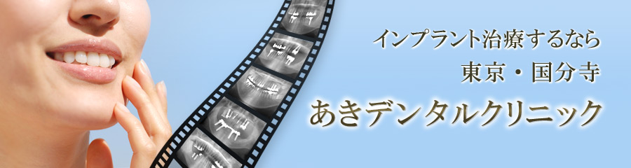 インプラントの実績